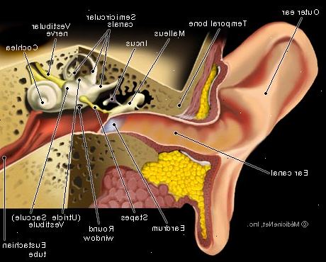 Hur man botar en öronvärk. Applicera en varm över den smärtsamma örat.