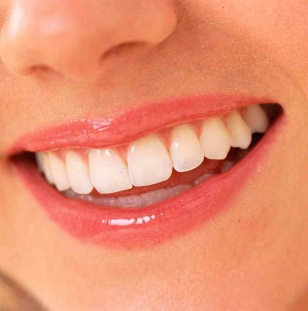 Hur man har rena, vita tänder. Skölj munnen med kallt vatten i ca 30 sekunder för att bli av med allt löst skräp mellan tänderna.