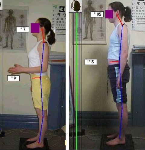 Hur man korrigera framåt huvudet kroppshållning. Stå med ryggen tätt mot en vägg.