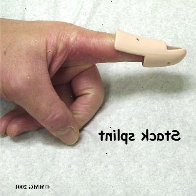 Hur man ska behandla mallet finger med bettskena. Se en läkare omedelbart.