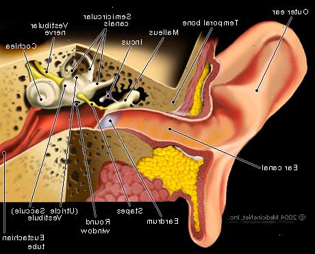 Hur man kan behandla en infektioner i mellanörat. Rengör dränering från örat (om någon).