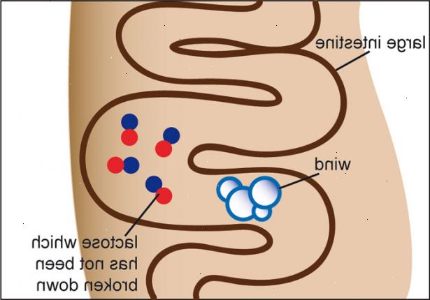 Hur man känner igen symptom på laktosintolerans. Försök att märka när din buksmärtor förekommer.